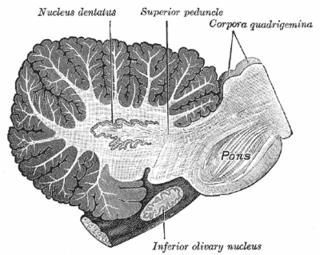 <span class="mw-page-title-main">Dentate nucleus</span> Nucleus in the centre of each cerebellar hemisphere