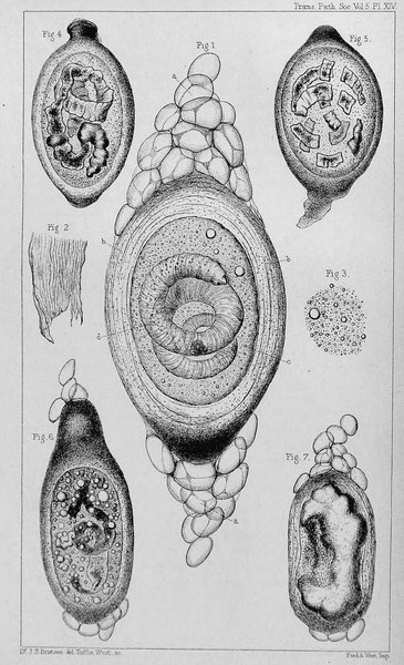 Fig. 1. Cyste. a a. polair vet; b b. gelaagde wanden; c. korrelig materiaal binnenin; d. L1-larve. Fig. 4 t/m 7 Afstervingsfasen cyste.