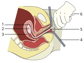 <span class="mw-page-title-main">Abortion under Egyptian law</span> Part of the Egyptian Penal Law.