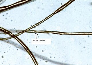 <span class="mw-page-title-main">Pili torti</span> Medical condition