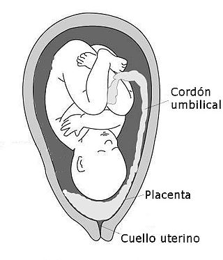 <span class="mw-page-title-main">Placenta praevia</span> Medical condition