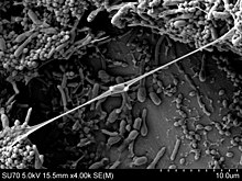 Scanning electron micrograph of mixed-culture biofilm, demonstrating in detail a spatially heterogeneous arrangement of bacterial cells and extracellular polymeric substances. Mixed-culture biofilm.jpg