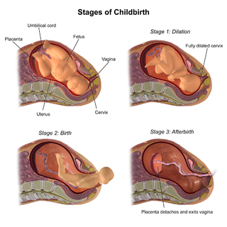 <span class="mw-page-title-main">Emergency childbirth</span>