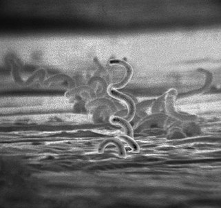 Bacterias vistas en microscopio electrónico de barrido