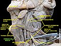 Múscul esternohioidal. Vista lateral.