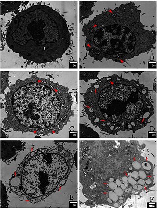 <span class="mw-page-title-main">Paraptosis</span> Type of programmed cell death distinct from apoptosis and necrosis