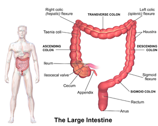 <span class="mw-page-title-main">Pancolitis</span> Medical condition