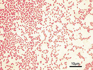 <span class="mw-page-title-main">Gram-negative bacteria</span> Group of bacteria that do not retain the Gram stain used in bacterial differentiation