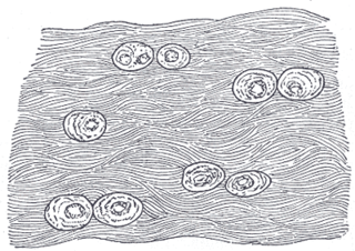 <span class="mw-page-title-main">Fibrocartilage</span> Type of tissue