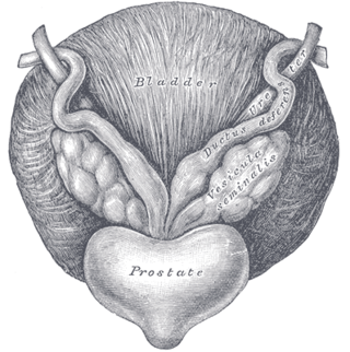 <span class="mw-page-title-main">Prostatectomy</span> Surgical removal of all or part of the prostate gland