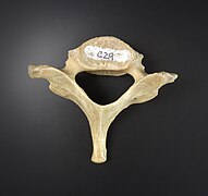 Vertebra - cervicales.jpg