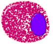 Eosinophilic Eosonophilic myelocyte.png