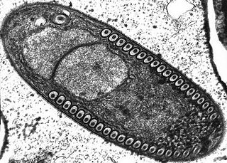 <span class="mw-page-title-main">Microsporidia</span> Phylum of fungi