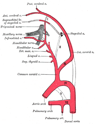 <span class="mw-page-title-main">Persistent stapedial artery</span> Blood vessel anomaly