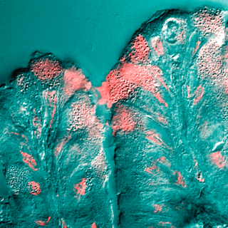 <span class="mw-page-title-main">Mucus</span> Secretion produced by mucous membranes