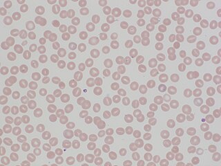 <span class="mw-page-title-main">Hereditary stomatocytosis</span> Medical condition