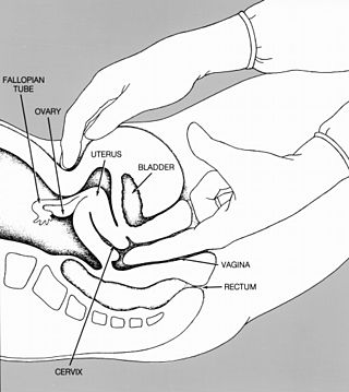 <span class="mw-page-title-main">Pelvic examination</span> Physical medical examination