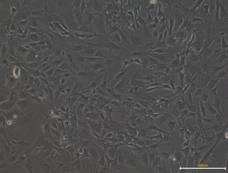 <span class="mw-page-title-main">Mouse embryonic fibroblast</span>