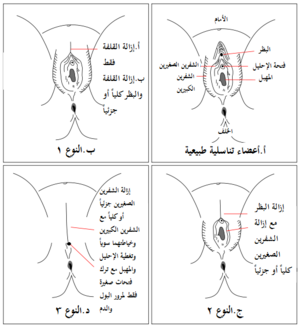 رسم بياني