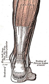 Tendinopathy Medical condition