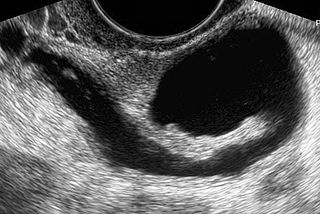 <span class="mw-page-title-main">Gynecologic ultrasonography</span>