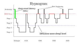 <span class="mw-page-title-main">Rapid eye movement sleep</span> Phase of sleep characterized by random and rapid eye movements