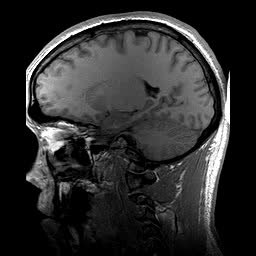 <span class="mw-page-title-main">Magnetic resonance imaging</span> Medical imaging technique