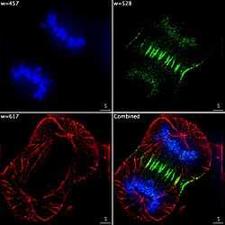 Epifluorescent imaging of the three components in a dividing human cancer cell. DNA is stained blue, a protein called INCENP is green, and the microtubules are red. Each fluorophore is imaged separately using a different combination of excitation and emission filters, and the images are captured sequentially using a digital CCD camera, then superimposed to give a complete image.