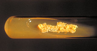 <span class="mw-page-title-main">Nocardiaceae</span> Family of bacteria