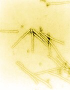 Electron micrograph of the rod-shaped particles of tobacco mosaic virus