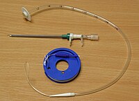 PEG tube, cannula and guidewire (Pull Technique) PEG tube kit.jpg