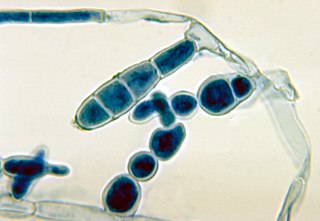 <i>Epidermophyton floccosum</i> Species of fungus