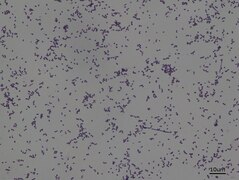 Nocardia in Gram Stain.tif