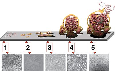 Five stages of biofilm development
(1) Initial attachment, (2) Irreversible attachment, (3) Maturation I, (4) Maturation II, and (5) Dispersion. Each stage of development in the diagram is paired with a photomicrograph of a developing P. aeruginosa biofilm. All photomicrographs are shown to the same scale. Biofilm.jpg