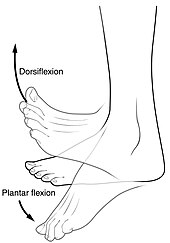 Achilles tendon tightness is a risk factor for plantar fasciitis. It can lead to decreased dorsiflexion of the foot. Dorsiplantar.jpg