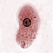 Entamoeba histolytica (Archamoebea)