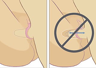 <span class="mw-page-title-main">Soaking (sexual practice)</span> Mormon premarital sex avoidance method