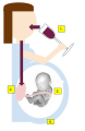 Fetal Alcohol Syndrome 1. Alcohol consumed (EtOH) 2. Alcohol crosses into the placenta. 3. Alcohol Metabolizes. 4. FAEE detected in meconium.