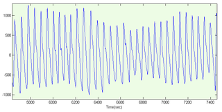 <span class="mw-page-title-main">Photoplethysmogram</span> Chart of tissue blood volume changes