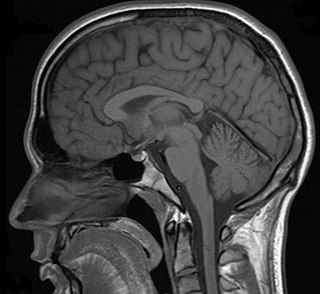 <span class="mw-page-title-main">Differential diagnoses of depression</span> Differential diagnoses