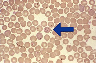 <span class="mw-page-title-main">Babesiosis</span> Malaria-like parasitic disease caused by infection with the alveoate Babesia or Theileria