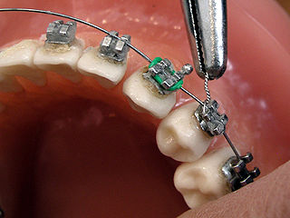 <span class="mw-page-title-main">Orthodontics</span> Correctional branch of dentistry