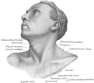 <span class="mw-page-title-main">Torticollis</span> Abnormal, asymmetrical head or neck position