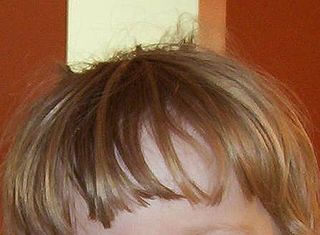 <span class="mw-page-title-main">Bangs (hair)</span> Fringe of hair covering the human forehead