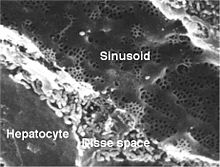 Scanning electron micrograph of a liver sinusoid with fenestrated endothelial cells.