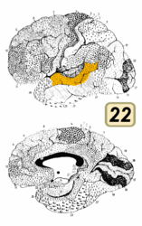 ブロードマンの脳地図における22野。22野の後部（図中オレンジ色の部分の右半分ほど）はウェルニッケ野（聴覚性言語野）にあたる。