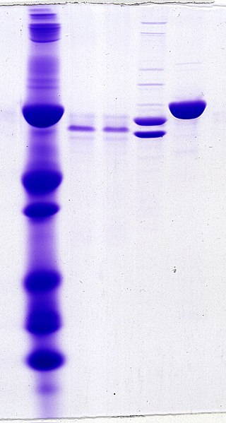 <span class="mw-page-title-main">Gel electrophoresis of proteins</span> Technique for separating proteins