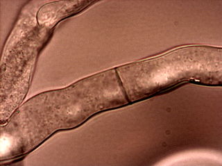 <i>Neurospora crassa</i> Species of ascomycete fungus in the family Sordariaceae