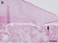 February 26: microscopic view of osteochondrosis in the joint of a sow