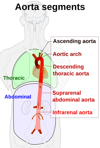 <span class="mw-page-title-main">Aorta</span> Largest artery in the human body